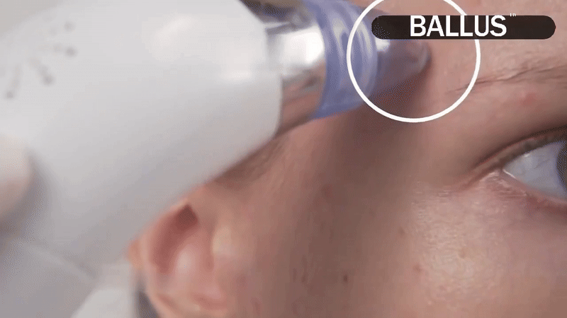Jaysuin - Nail Fungus Spray